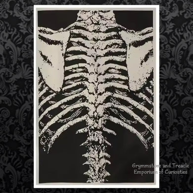 Spine, Ribcage and Scapula Large Iron on Patch