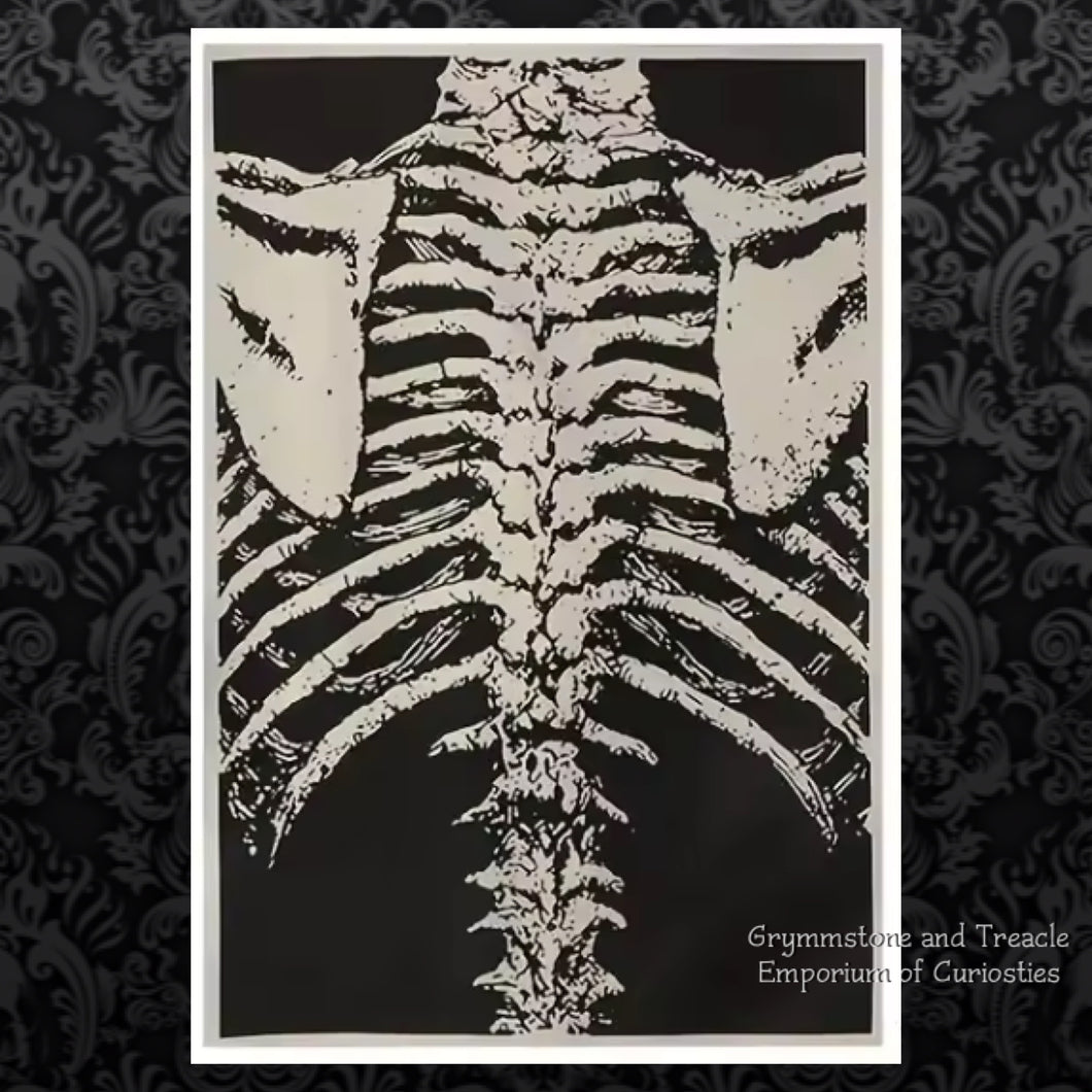 Spine, Ribcage and Scapula Large Iron on Patch